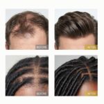 Herbal Hair Growth Oil – Extra Strength Natural Rosemary + Fenugreek Infused Blend with 10 Plant Oils for Stronger, Fuller-Looking Hair & Nourished Scalp | Vegan & Pure | 3.38 fl oz - Image 6