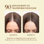 Hair Growth Serum: Rosemary Batana Castor Oil Rice Water Biotin Hair Oils for Hair Growth - Hair Growth Thickening Product - Hair Loss Treatments for Women Men(50 ML) - Image 5