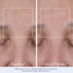 Obagi ELASTIderm Lift Up & Sculpt Facial Moisturizer – Clinically Proven Anti-Aging Face Cream that Visibly Firms & Sculpts Facial Contours, & Reduces Fine Lines & Wrinkles with Peptides – 1.7 oz - Image 6