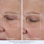 Obagi ELASTIderm Lift Up & Sculpt Facial Moisturizer – Clinically Proven Anti-Aging Face Cream that Visibly Firms & Sculpts Facial Contours, & Reduces Fine Lines & Wrinkles with Peptides – 1.7 oz - Image 5