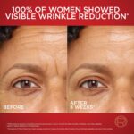 L'Oreal Paris Revitalift Triple Power Anti-Aging Face Moisturizer, Fragrance Free, Pro Retinol, Hyaluronic Acid & Vitamin C to Reduce Wrinkles, Firm & Brighten Skin, 2.55 Oz - Image 4