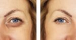 BESHA INC Verisol Collagen Bioactive Peptides (Natural Collagen Powder) Made in Germany - Image 3