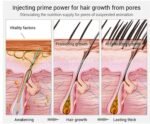 Hair Growth Serum Oil for Women & Men – 100% Natural Herbal Extracts, Follicle Nourishing Scalp & Root Revive Formula for Thicker, Fuller & Healthy-Looking Hair, Hydration for Dry & Damaged Hair - Image 5