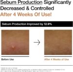 Anua Rice 70 Glow Milky Toner, Glass & Dewy Skin, Hydrating & Barrier Care, Rice Water, Niacinamide, Ceramides, All Skin Types, Fragrance-Free, Non Comedogenic, Korean Skincare, 8.45 fl.oz. - Image 7