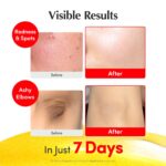 EQQUALBERRY Vitamin Illuminating Serum | Niacinamide 4% + Brightening Vitamin C Face Serum with Hyaluronic Acid & Vitamin E | Dark Spot, Uneven Tone Care | Korean Skincare, 1.01 fl.oz - Image 4