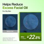 Anua Azelaic Acid 10 Hyaluron Redness Soothing Serum, Facial Serum for Blemish-Prone & Oily-Prone Skin, Lightweight & Hydrating Blemish Care, Hyaluronic Acid, Korean Skincare, 1.01 fl oz. - Image 6