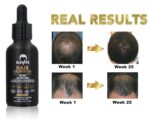 Elevate Hair Regrowth Treatment 5% Minoxidil Solution - Biotin Serum Hair Growth Oil for Men & Women - Thicker Fuller Stronger Hair - Stops Hair Loss & Thinning - Natural Hair Thickening Treatment 1oz - Image 3
