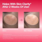 Anua Niacinamide 10 + TXA 4 Serum, Dark Spot Care, Hyaluronic Acid, Tranexamic Acid, Lightweight & Hydrating All-in-One Daily Facial Serum for Glass Skin, Korean Skincare, 1.01 fl.oz - Image 4