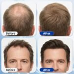 Hair Growth Serum Roll On with 3% Rosemary,3% Batana Oil,2% Pea Extract,2% Ginger Root Oil,Stronger Root,stimulate follicle,Hair Thicker,Hair Loss Treatment,Hair Growth Serum(30ML/1.01FL.OZ) - Image 5