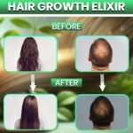Hair Growth Elixir | Natural Hair Growth Oil for Scalp & Beard | Hair fall control Serum for Women & Men | Rosemary, Castor Oil, Biotin | Treatment for Longer Hair & Beard | 4.05 Fl Oz - Image 6