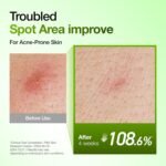 Anua Azelaic Acid 10 Hyaluron Redness Soothing Serum, Facial Serum for Blemish-Prone & Oily-Prone Skin, Lightweight & Hydrating Blemish Care, Hyaluronic Acid, Korean Skincare, 1.01 fl oz. - Image 4