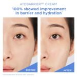 AESTURA ATOBARRIER365 Cream with Ceramides, Korean Face Moisturizer for Barrier Repair | 120H lasting Hydration, Ceramide Capsules, Dry & Sensitive Skin, Non-comedogenic, 80 mL / 2.70 fl.oz. - Image 7