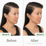 Divi Scalp Serum for Thinning Hair Clinically Tested, Non-Greasy Formula with Amino Acids, Caffeine & Rosemary Oil Promotes Healthy Scalp & Fuller-Looking Hair, Reduces Oil & Product Buildup - Image 4