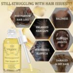 Natural Hair Growth Oil Kit with Rosemary Hair Oils for Hair Growth for Dry Damaged Hair, for Men and Women 2PCS*2 fl.oz (Yellow) - Image 3