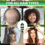 Hair Growth Elixir | Natural Hair Growth Oil for Scalp & Beard | Hair fall control Serum for Women & Men | Rosemary, Castor Oil, Biotin | Treatment for Longer Hair & Beard | 4.05 Fl Oz - Image 5