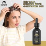 Elevate Hair Regrowth Treatment 5% Minoxidil Solution - Biotin Serum Hair Growth Oil for Men & Women - Thicker Fuller Stronger Hair - Stops Hair Loss & Thinning - Natural Hair Thickening Treatment 1oz - Image 4
