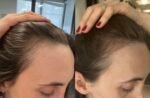 BUR BUR Growing Season Hair Growth And Repair Oil | With Burdock, Nettle Oil and Vitamin C for Visibly Fuller, Stronger and Shinier Hair. - Image 7