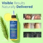 Rosemary, Tea Tree, & Castor Oil for Hair Growth & Dandruff Relief (6.7 fl oz), Infused with Biotin, Black Sesame, Grapeseed, Jojoba, & Vitamin E Oils for Dry, Itchy Scalp, Thickening & Hydration - Image 6