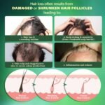 Hair Growth Serum Roll-On: Advanced Scalp Stimulator with 16 Botanical Extracts Veganic Natural Hair Growth Oil for Thicker Fuller Hair - Image 6
