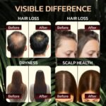 Batana Oil for Hair Growth - 100% Pure & Unrefined - Raw Natural Dr. Sebi Botana Oil - Scalp Health, Strengthens, Thickens & Hydrates - Repairs Split Ends - Prevents Hair Loss for Men & Women - Image 4