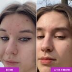 Good Molecules Niacinamide Serum - 10% Niacinamide to Target Blemishes, Nourishment, and Skin Tone - Ultra Hydrating Serum and Brightening Skin Care for Face - Image 4