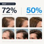 Be Bodywise Hair Growth Serum Roll On - 5% Saw Palmetto, 3% Rosemary Oil for Hair Growth, 3% Fenugreek,1% Caffeine Herbasome | Serum for Hair Loss & Hair Regrowth For Men & Women 25ml/0.84 fl oz - Image 2