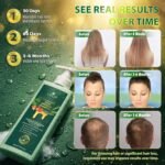 Rosemary & Batana Oil Hair Growth Shampoo: Hair Loss Shampoo for Men and Women with Biotin, Sulfate & Fragrance-Free Thickening - Image 5