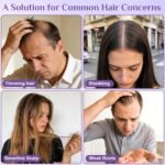 Rosemary Hair Growth Serum Roll-On | Rosemary Oil, Biotin, Anagain, Caffeine, Niacinamide | Fleird™ X7 Technology – Thinning Hair & Hair Fall – Thicker, Fuller Hair for Women & Men,1 Fl Oz (Pack of 2) - Image 5