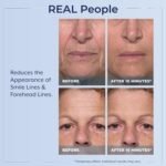 Plexaderm Rapid Reduction Eye Serum - Visibly Reduces Under-Eye Bags, Wrinkles, Dark Circles, Fine Lines & Crow's Feet Instantly, Anti Aging Wrinkle Remover for Face, Full Size Tube - Image 4