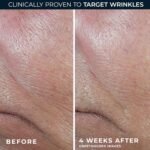 RoC Derm Correxion Retinol Firming Serum Stick with Antioxidants to Visibly Tighten and Firm Wrinkles and Laugh Lines 1.0 oz plus Retinol Eye Cream Packette - Image 5