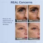 Plexaderm Rapid Reduction Eye Serum - Visibly Reduces Under-Eye Bags, Wrinkles, Dark Circles, Fine Lines & Crow's Feet Instantly, Anti Aging Wrinkle Remover for Face, Full Size Tube - Image 5