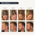 Be Bodywise Hair Growth Serum Roll On - 5% Saw Palmetto, 3% Rosemary Oil for Hair Growth, 3% Fenugreek,1% Caffeine Herbasome | Serum for Hair Loss & Hair Regrowth For Men & Women 25ml/0.84 fl oz - Image 5