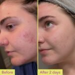 Good Molecules 10% Azelaic Acid Treatment for Face – Soothing Formula for Facial Redness & Uneven Tone – Brightens Dark Spots & Refines Texture – Vegan & Fragrance-Free Skincare (30ml / 1.01 fl oz.) - Image 3