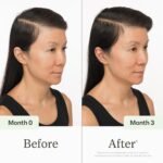 Divi Scalp Serum for Thinning Hair Clinically Tested, Non-Greasy Formula with Amino Acids, Caffeine & Rosemary Oil Promotes Healthy Scalp & Fuller-Looking Hair, Reduces Oil & Product Buildup - Image 4