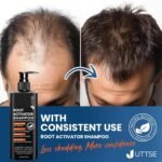 Root Activator Shampoo for Men: Hair Growth Shampoo for Hair Loss and Thinning Hair - Image 6
