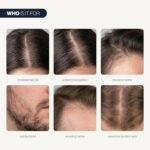 Be Bodywise Hair Growth Serum Roll On - 5% Saw Palmetto, 3% Rosemary Oil for Hair Growth, 3% Fenugreek,1% Caffeine Herbasome | Serum for Hair Loss & Hair Regrowth For Men & Women 25ml/0.84 fl oz - Image 3