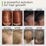 Ella & Eden Hair Growth Oil with Rosemary, Castor, Peppermint Oils & Biotin - Dry Scalp Treatment - Strengthening, Repairing, Soothing - 2 Fl Oz Glass Bottle - Image 2