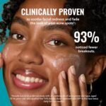 Good Molecules 10% Azelaic Acid Treatment for Face – Soothing Formula for Facial Redness & Uneven Tone – Brightens Dark Spots & Refines Texture – Vegan & Fragrance-Free Skincare (30ml / 1.01 fl oz.) - Image 5