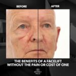 Beverly Hills Mens Instant Facelift and Eye Serum Treatment for Dark Circles, Puffy Eyes, and Wrinkles - Image 2