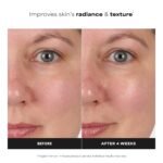 Paula's Choice SKIN BALANCING Pore-Reducing Face Toner with Niacinamide, for Oily Skin & Combination, Minimizes Large Pores, Controls Oil & Shine, Hydrates & Replenishes, Fragrance-Free - Image 4