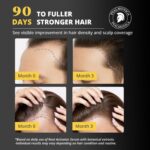 Hair Growth Serum: Root Activator Scalp Treatment for Hair Loss & Regrowth with Rosemary Oil - Botanical DHT Blocker Hair Thickening Formula for Thinning Hair - for Women & Men (1 Fl Oz (Pack of 1)) - Image 3