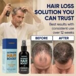 Moerie Hair Growth Serum Spray for Men and Women, Hair Loss Solution with Biotin and Rosemary, Thickening Serum for Hair Regrowth and Thinning Hair - Ultimate Scalp and Growth Care - Image 5