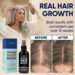 Moerie Hair Growth Serum Spray for Men and Women, Hair Loss Solution with Biotin and Rosemary, Thickening Serum for Hair Regrowth and Thinning Hair - Ultimate Scalp and Growth Care - Image 4