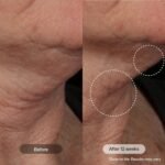 Revision Skincare Nectifirm Advanced® Neck Cream – Clinically Proven to Firm, Lift & Contour the Neck, Jawline & Décolletage, Correcting Visible Signs of Aging and Weight Loss - Image 3