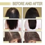 Natural Hair Growth Oil for Dry, Damaged & Thin Hair, Nourishing Unisex Formula (3 * 60ml) - Image 4