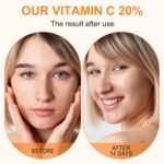 Premium 20% Vitamin C Serum For Face with Hyaluronic Acid, Retinol & Amino Acids - Boost Skin Collagen,Hydrate & Plump Skin, Anti Aging & Wrinkle Facial Serum 60ml - Image 5