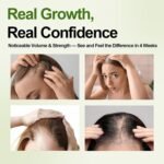 Hair Growth Oil Foam with Rosemary and Castor Oil Vegan Natural Formula for Thinning Hair Organic Plant Based Scalp Treatment Non Greasy Hair Regrowth Support for Men and Women 3 Bottles Each 2.11 oz - Image 4