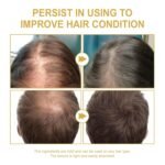 180 ML EELHOE Hair Growth Oil, Natural Rosemary Hair Growth Oil for Dry Damaged Hair and Growth Thin Hair. (3Pcs) - Image 3