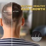 5% Minoxidil Hair Growth Serum for Men & Women - for Stronger Thicker Longer, Hair Regrowth Treatment- 2.02 oz - Image 5