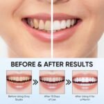 Collagen Gum Powder, Collagen Powder for Gums, with Hydroxyapatite and Collagen Peptides for Gum Care, 1.76 Oz / 50g (1 PCS) - Image 2